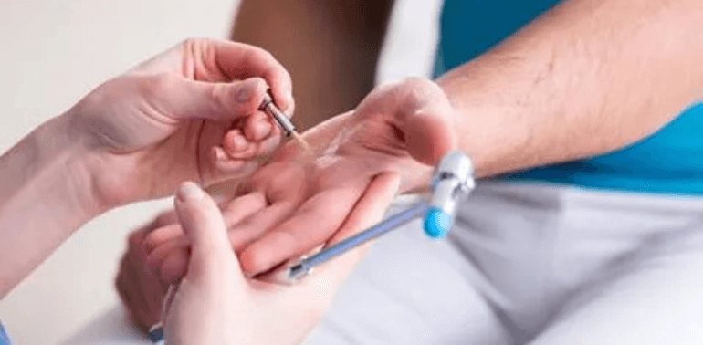 Neurological Physiotherapy