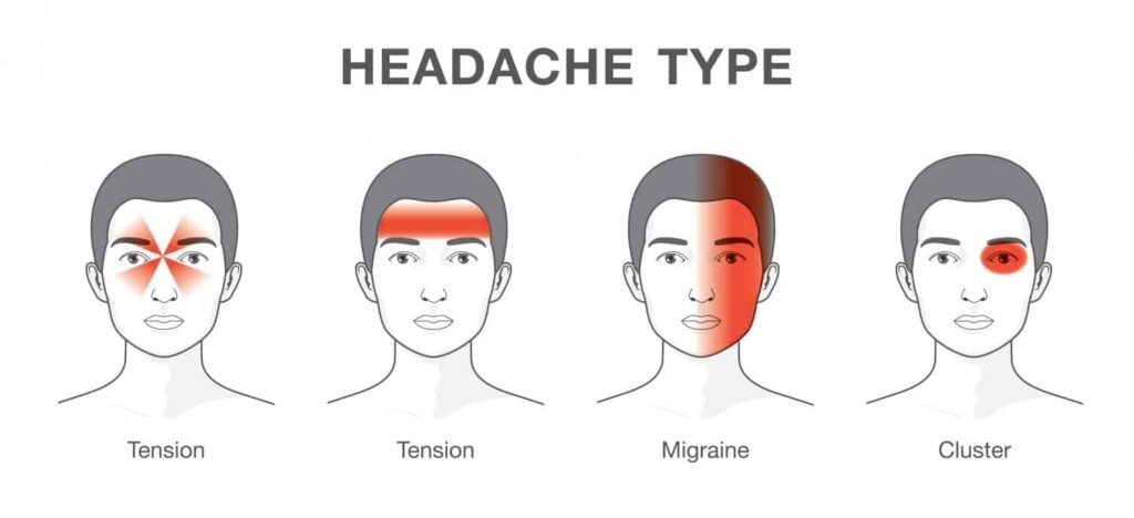 Headaches: Causes and Symptoms